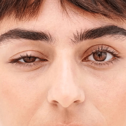 Oculoplasty-min