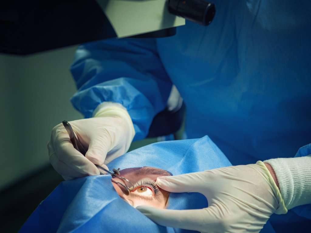 Cataract Surgery in Ambikapur