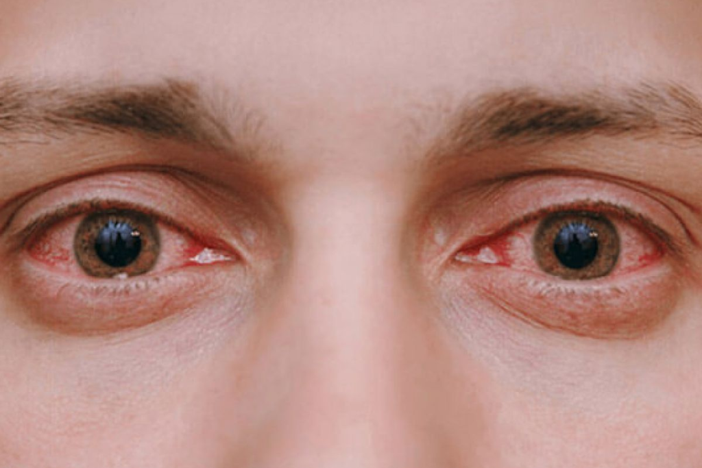 Ophthalmologists Hospital in Ambikapur